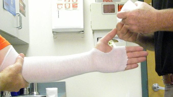 cast